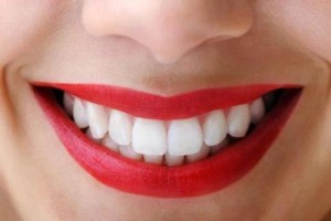 nice-smile