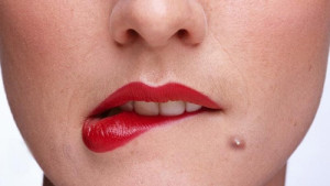 white-head-pimple