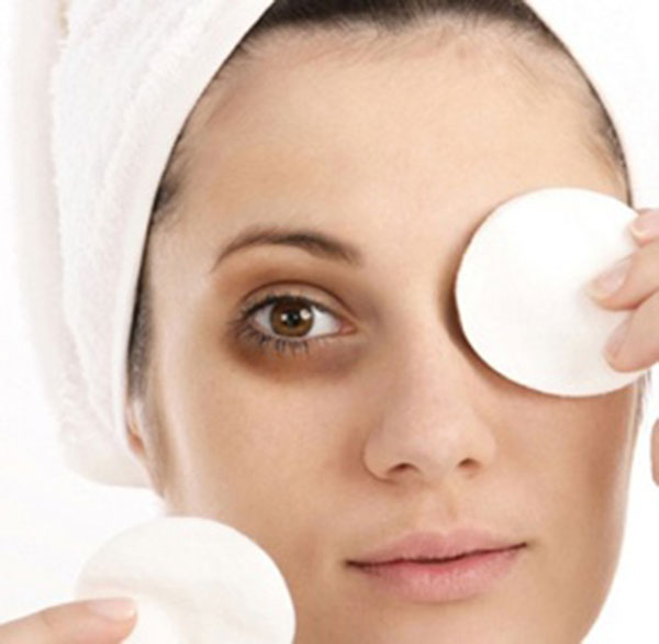 reduce-dark-circles