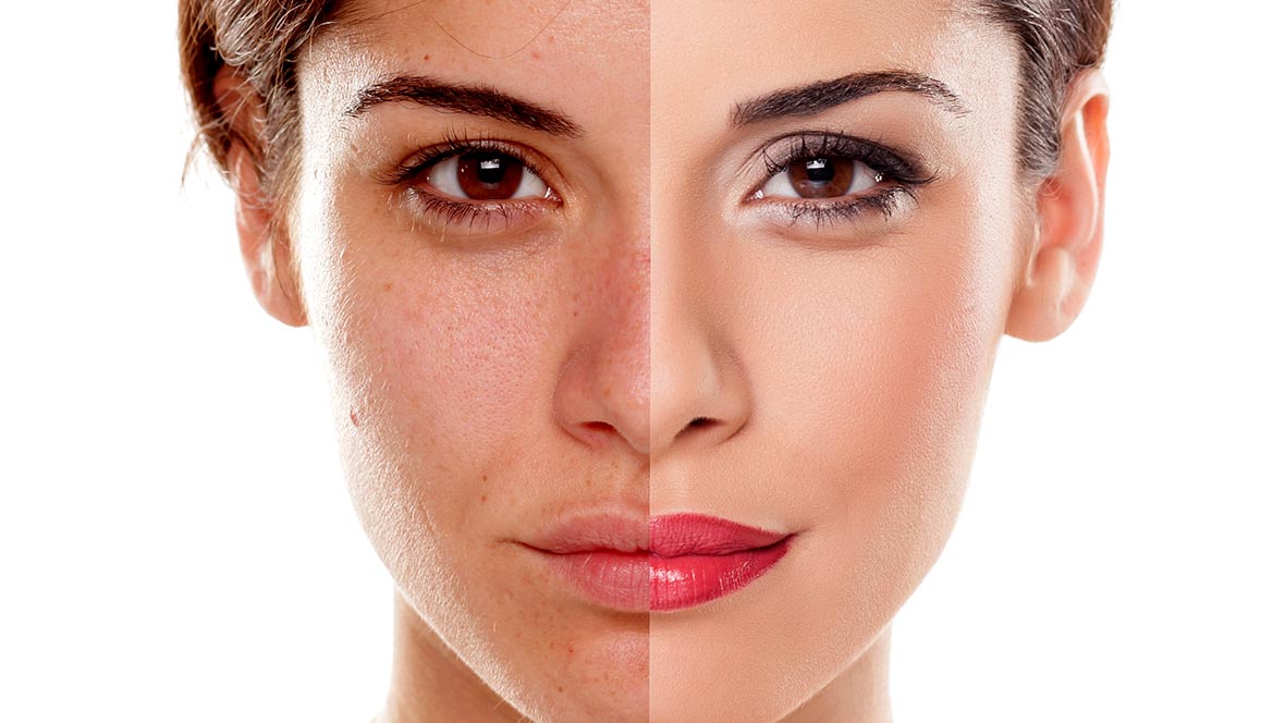 How-to-Brighten-Dull-Skin